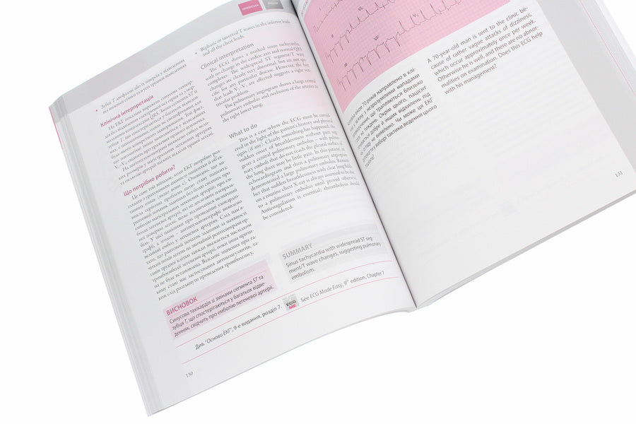 150 ECG cases / 150 ECG Cases / 150 випадків ЕКГ / 150 ECG Cases Джон Хэмптон, Джоанна Хэмптон 978-617-505-784-1-6