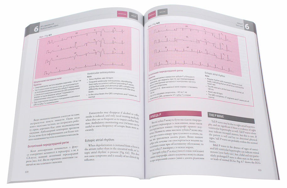 Basics of ECG / The ECG Made Easy / Основи ЕКГ / The ECG Made Easy Джон Хэмптон, Джоанна Хэмптон 978-617-505-776-6-6