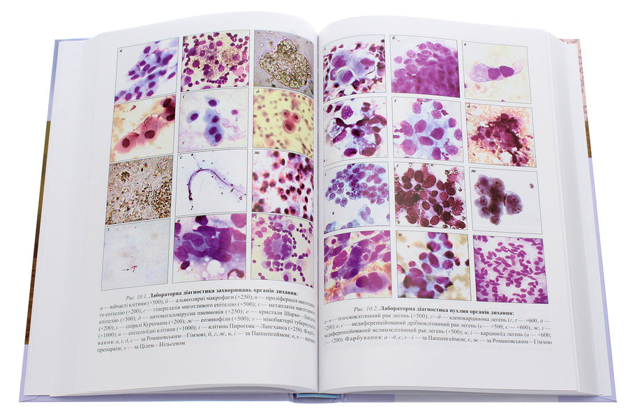 Clinical laboratory diagnostics. Textbook / Клінічна лабораторна діагностика. Підручник 978-617-505-838-1-6