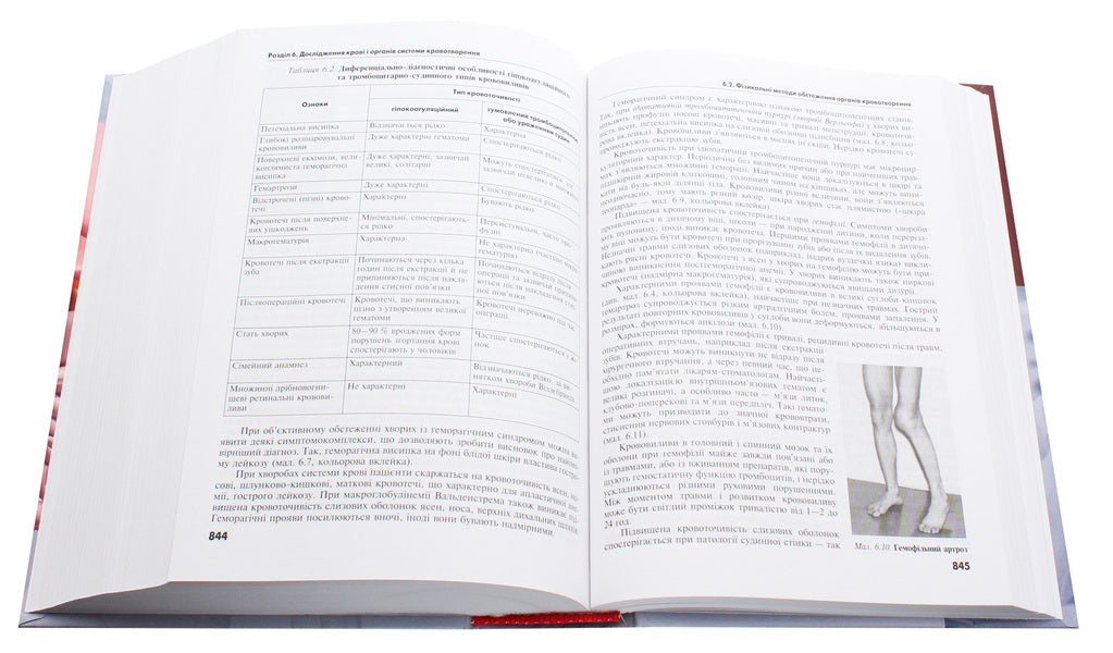 Diagnostic methods in the clinic of internal medicine / Методи діагностики в клініці внутрішньої медицини Анатолий Свинцицкий 978-617-505-768-1-6