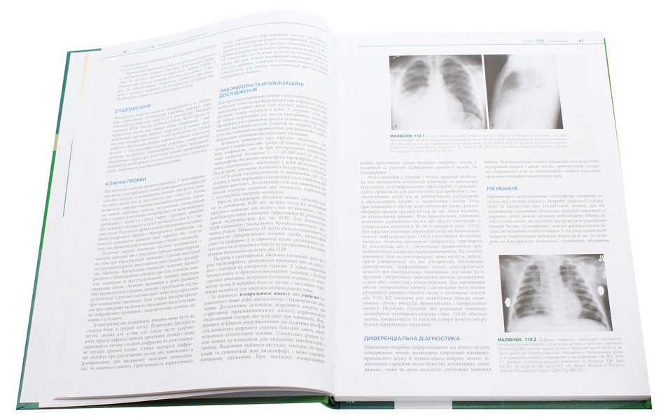 Fundamentals of pediatrics according to Nelson in 2 volumes. Volume 2 / Основи педіатрії за Нельсоном у 2-х томах. Том 2 Карен Дж. Маркданте, Роберт М. Клигман 978-617-505-780-3-6