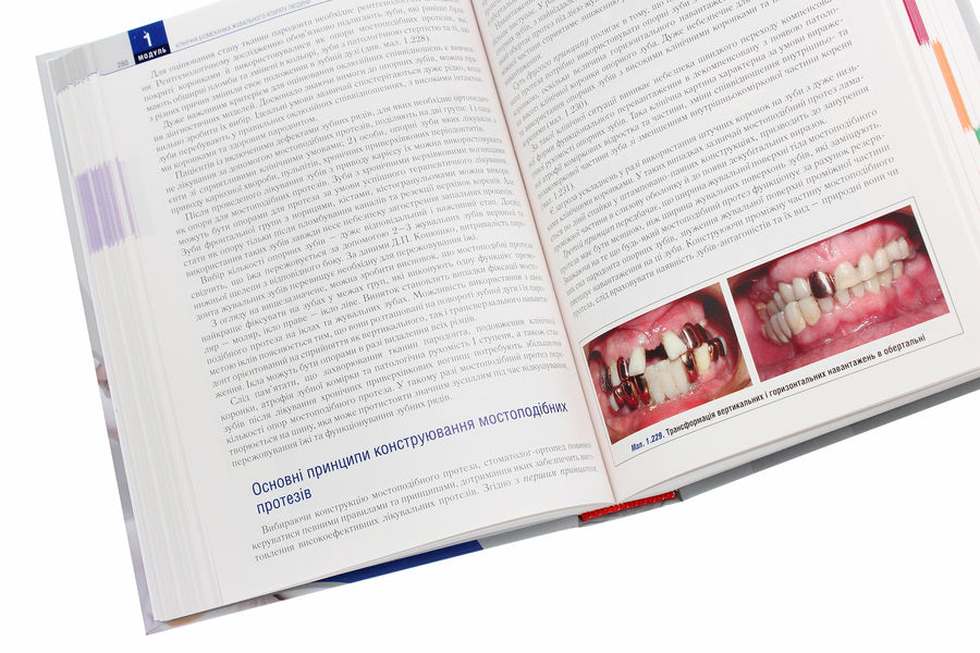 Orthopedic dentistry. Textbook / Ортопедична стоматологія. Підручник Иван Палийчук, М.М. Рожко, Валерий Неспрядько 978-617-505-781-0-6