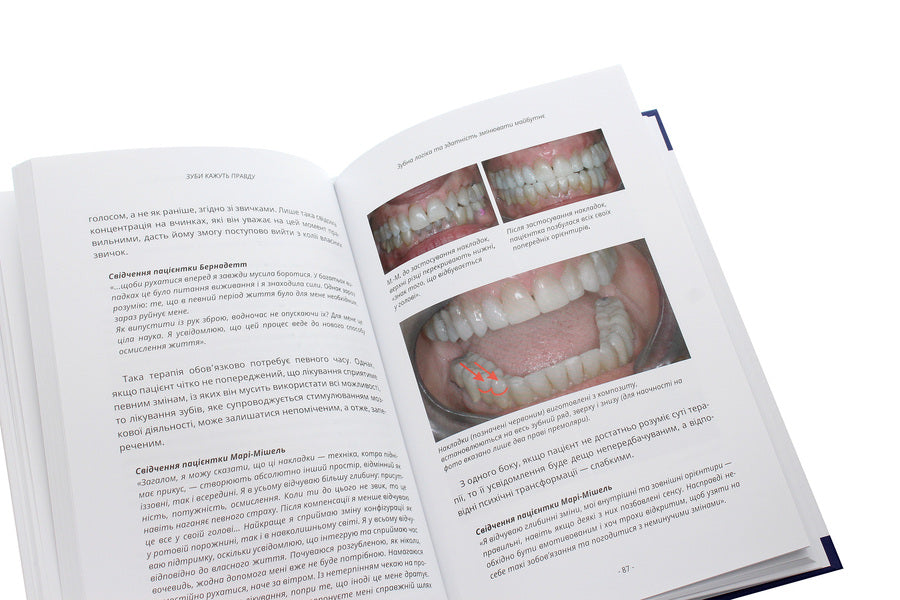 Teeth tell the truth. Paradigm of the Stomatognathic System / Зуби кажуть правду. Парадигма Стоматогнатичної Системи Родриг Матье, Жан-Франсуа Ардуэн 978-617-614-318-5-6