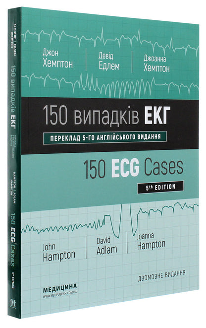 150 ECG cases / 150 ECG Cases / 150 випадків ЕКГ / 150 ECG Cases Джон Хэмптон, Джоанна Хэмптон 978-617-505-784-1-3