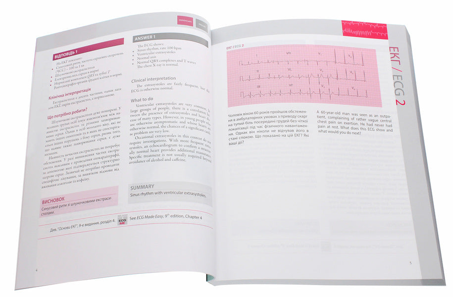 150 ECG cases / 150 ECG Cases / 150 випадків ЕКГ / 150 ECG Cases Джон Хэмптон, Джоанна Хэмптон 978-617-505-784-1-4