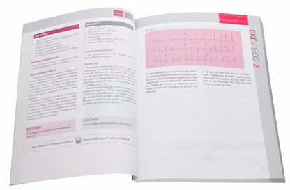 150 ECG cases / 150 ECG Cases / 150 випадків ЕКГ / 150 ECG Cases Джон Хэмптон, Джоанна Хэмптон 978-617-505-784-1-4