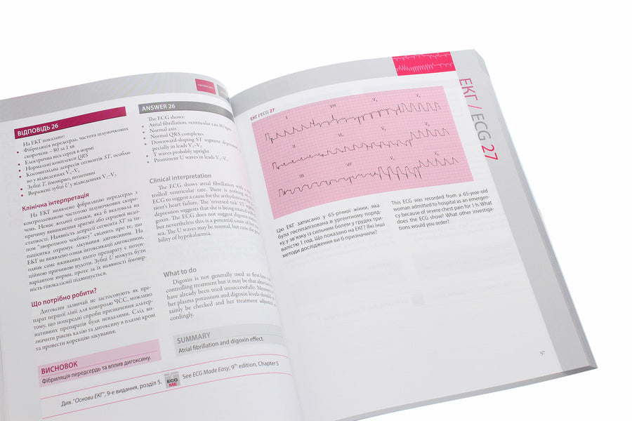 150 ECG cases / 150 ECG Cases / 150 випадків ЕКГ / 150 ECG Cases Джон Хэмптон, Джоанна Хэмптон 978-617-505-784-1-5