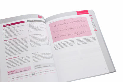 150 ECG cases / 150 ECG Cases / 150 випадків ЕКГ / 150 ECG Cases Джон Хэмптон, Джоанна Хэмптон 978-617-505-784-1-5