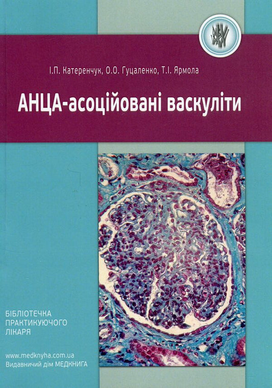 ANCA-associated vasculitis / АНЦА-асоційовані васкуліти Иван Катеренчук, О.О. Гуцаленко, Татьяна Ярмола 978-617-7994-08-3-1