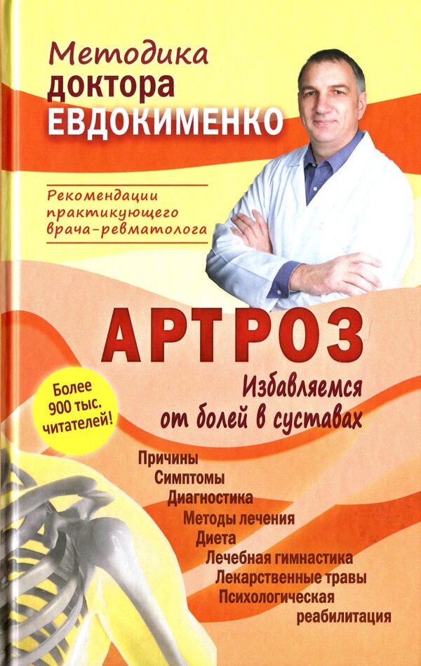 Arthrosis. Get rid of joint pain / Артроз. Избавляемся от болей в суставах Павел Евдокименко 978-966-498-773-5-1