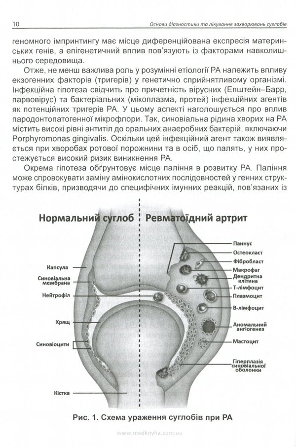 Basics of diagnosis and treatment of joint diseases / Основи діагностики та лікування захворювань суглобів Лариса Журавлева, Мария Олейник, Юлия Сикало, Владимир Федоров 978-966-1597-78-4-6