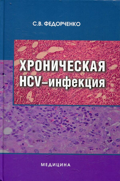 Chronic HCV infection / Хроническая HCV-инфекция Сергей Федорченко 978-617-505-015-6-1