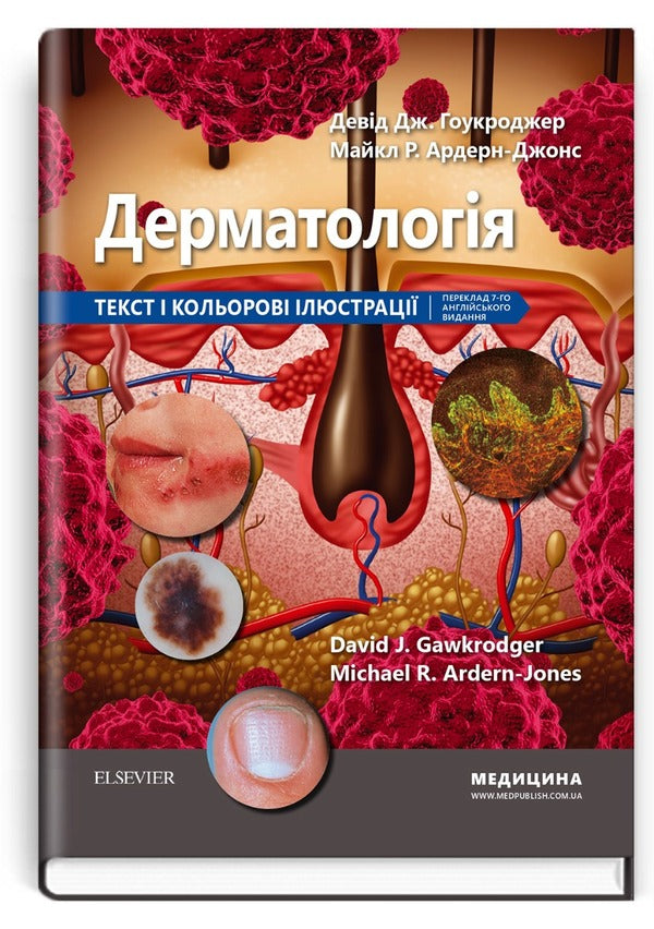 Dermatology: Text And Color Illustrations / Дерматологія: текст і кольорові ілюстрації Michael R. Ardern-Jones, David J. Hawkroder / Майкл Р. Ардерн-Джонс, Девід Дж. Гокрогер 9786175059371-1