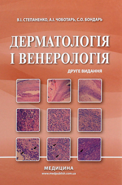 Dermatology and venereology. Textbook / Дерматологія і венерологія. Підручник Виктор Степаненко 978-617-505-811-4-1