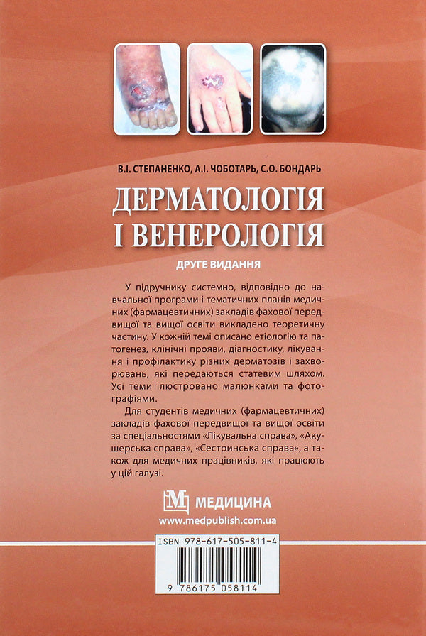 Dermatology and venereology. Textbook / Дерматологія і венерологія. Підручник Виктор Степаненко 978-617-505-811-4-2