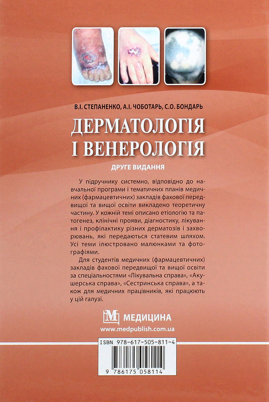 Dermatology and venereology. Textbook / Дерматологія і венерологія. Підручник Виктор Степаненко 978-617-505-811-4-2