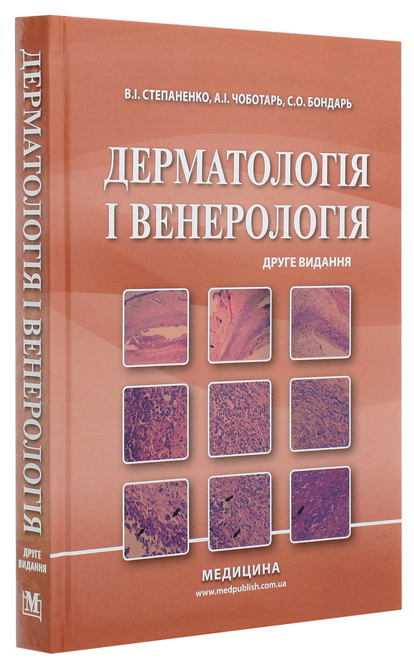 Dermatology and venereology. Textbook / Дерматологія і венерологія. Підручник Виктор Степаненко 978-617-505-811-4-3