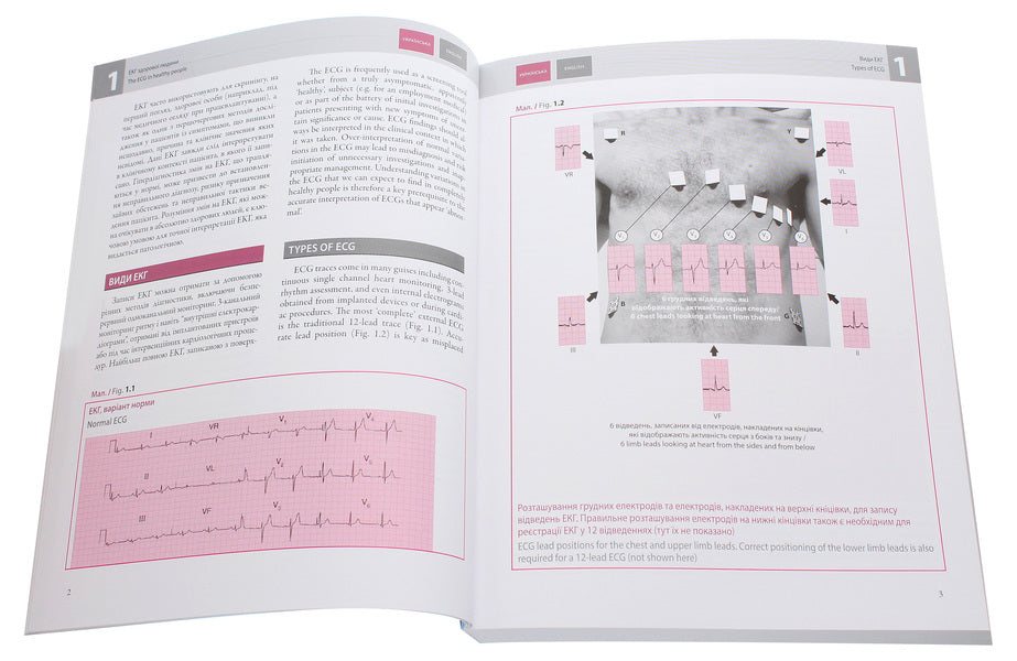 ECG in practice / The ECG Made Practical / ЕКГ у практиці / The ECG Made Practical Джон Хэмптон 978-617-505-794-0-4