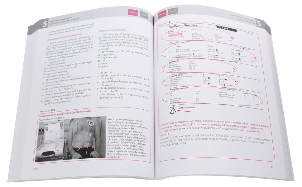 ECG in practice / The ECG Made Practical / ЕКГ у практиці / The ECG Made Practical Джон Хэмптон 978-617-505-794-0-6