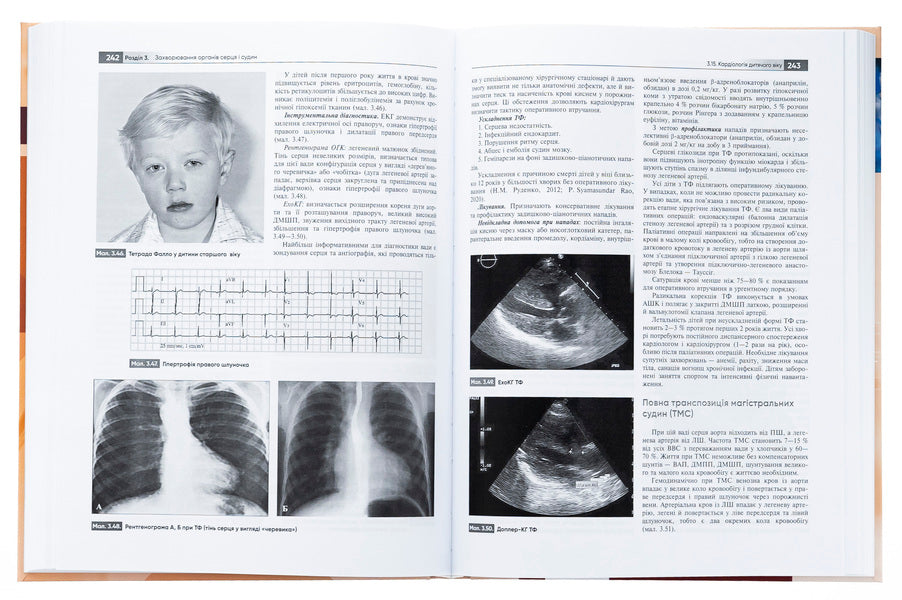 General practice is family medicine. In 3 books. Book 2. Internal medicine and pediatrics in general medical practice / Загальна практика — сімейна медицина. У 3-х книгах. Книга 2. Внутрішня медицина і педіатрія в загальнолікарській практиці Лилия Бабинец, М. Ю. Бабанина 978-617-505-997-5-6
