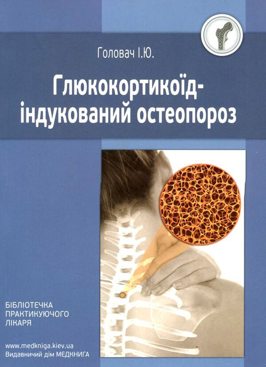 Glucocorticoid-induced osteoporosis / Глюкокортикоїд-індукований остеопороз Ирина Головач 978-966-1597-67-8-1