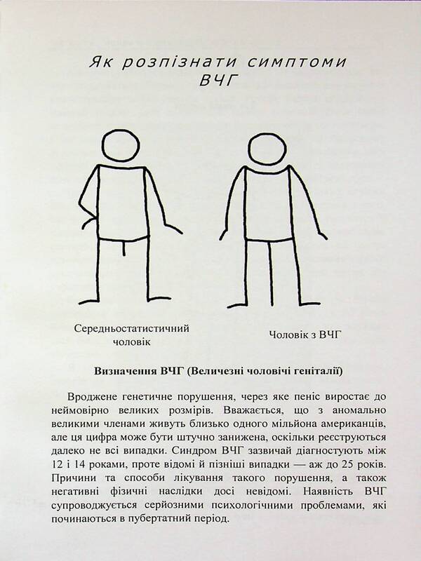 How to live if you have a huge penis. A small book that will help solve big problems / Як жити, якщо в тебе величезний пеніс. Маленька книжка, яка допоможе вирішити великі проблеми Ричард Джейкоб, Оуэн Томас 978-611-01-3555-9-5