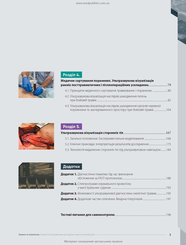 Injuries And Injuries Ultrasound Research Technology - Травми та поранення Технологя ультразвукових дослджень Eduard Svetlichnyi - Едуард Свтличний 9786178347208-5