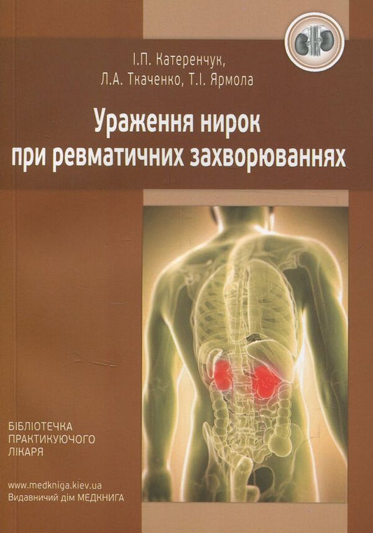 Kidney damage in rheumatic diseases / Ураження нирок при ревматичних захворюваннях Лидия Ткаченко, Иван Катеренчук, Татьяна Ярмола 978-966-1597-49-4-1