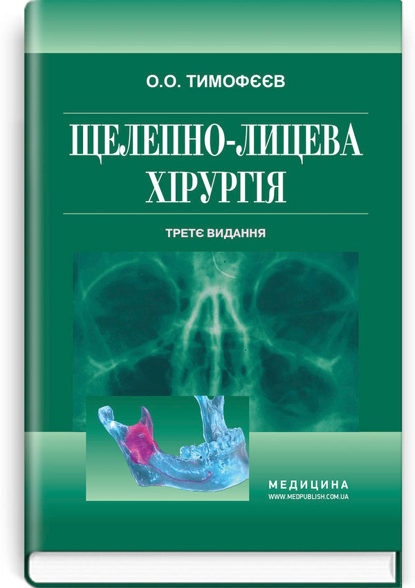 Maxillofacial surgery / Щелепно-лицева хірургія Алексей Тимофеев 978-617-505-881-7-1