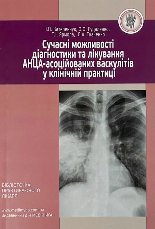 Modern Possibilities Of Diagnosis And Treatment Of Anza-Associated Vasculitis In Clinical Practice / Сучасні можливості діагностики та лікування АНЦА-асоційованих васкулітів у клінічній практиці Ivan Katherenchuk, OO Gutsalenko, Tatiana Yarmola / Іван Катерчеук, Оо. Гутсенко, Тетяна Ярмола 9786177994205-1