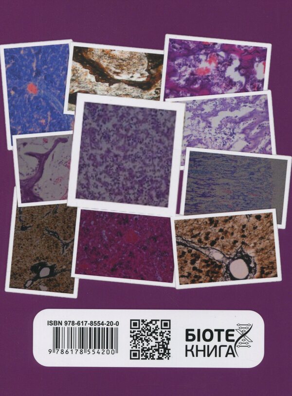 Morpho-Functional Features Of Histo- And Cytogenesis Of Organs Of Universal Hematopoiesis And Immune Protection In Domestic Pig Fetuses - Морфофункцональн особливост гсто- та цитогенезу органв унверсального кровотворення та мунного захисту у плодв свин свйсько Alexander Myrny - Олександр Мирний 9786178554200-2