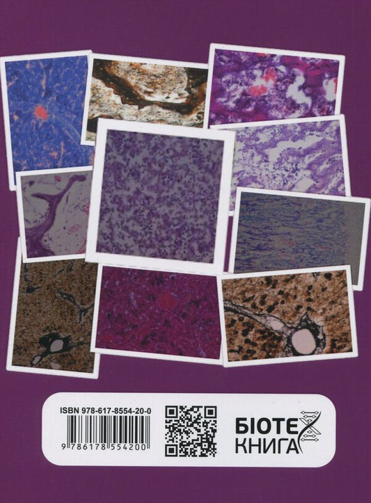 Morpho-functional features of histo- and cytogenesis of organs of universal hematopoiesis and immune protection in domestic pig fetuses / Морфофункціональні особливості гісто- та цитогенезу органів універсального кровотворення та імунного захисту у плодів свині свійської Александр Мирный 978-617-8554-20-0-2