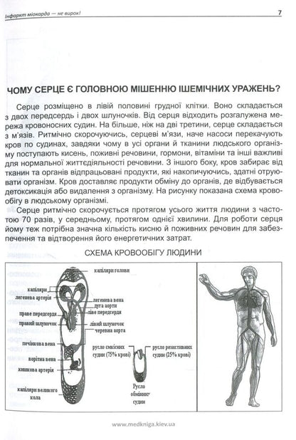 Myocardial infarction is not a sentence / Інфаркт міокарда — не вирок Иван Катеренчук 978-966-1597-33-3-5