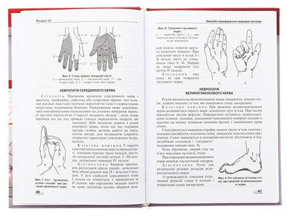 Neurology. Textbook / Неврологія. Підручник М. Карелина, Н. Касевич 978-617-505-995-1-5