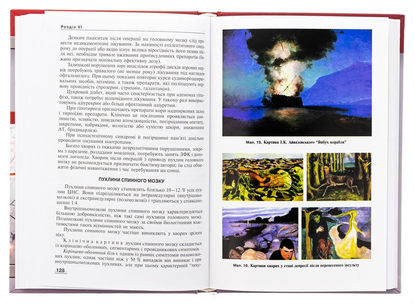 Neurology. Textbook / Неврологія. Підручник М. Карелина, Н. Касевич 978-617-505-995-1-6