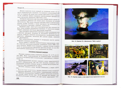 Neurology. Textbook / Неврологія. Підручник М. Карелина, Н. Касевич 978-617-505-995-1-6