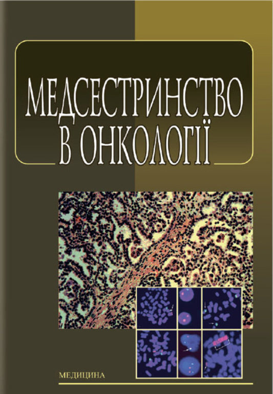 Nursing In Oncology / Медсестринство в онкології O. M. Pariychuk, K. Bobak, L. M. Kovalchuk / О. М. Парійчук, К. Бобак, Л. М. Ковальчук 9786175052655-1