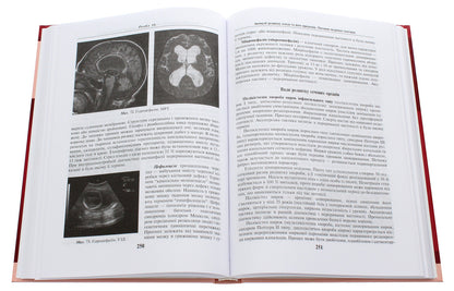 Obstetrics and gynecology. In 2 books. Book 1. Midwifery. Textbook / Акушерство і гінекологія. У 2 книгах. Книга 1. Акушерство. Підручник  978-617-505 823-7-5