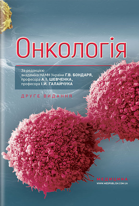 Oncology. Textbook / Онкологія. Підручник А. Шевченко, Г. Бондарь, И. Галайчук, Юрий Думанский 978-617-505-731-5-1