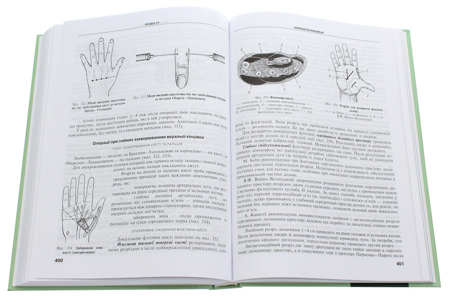 Operative surgery and topographical anatomy. Textbook / Оперативна хірургія та топографічна анатомія. Підручник Юрий Вовк, Юрий Ахтемийчук, Станислав Дорошенко 978-617-505-813-8-5