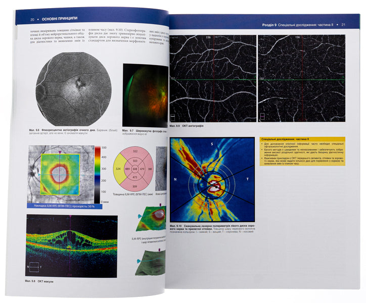 Ophthalmology / Офтальмологія Mark Butterbury, Conor Murphy, Colin Willoughby / Марк Баттербері, Конор Мерфі, Колін Віллоубі 9786175059739-6