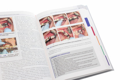 Orthopedic dentistry. Textbook / Ортопедична стоматологія. Підручник Иван Палийчук, М.М. Рожко, Валерий Неспрядько 978-617-505-781-0-5