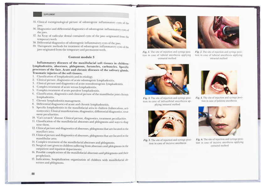 Pediatric Oral and Maxillofacial Surgery / Pediatric Oral and Maxillofacial Surgery Леонид Харьков, Л. Яковенко, Н. Киселева 978-617-505-772-8-6