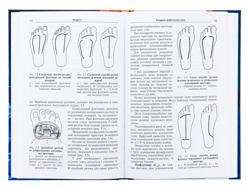 Purulent surgery / Гнійна хірургія Сергей Шаповал 978-617-505-991-3-5