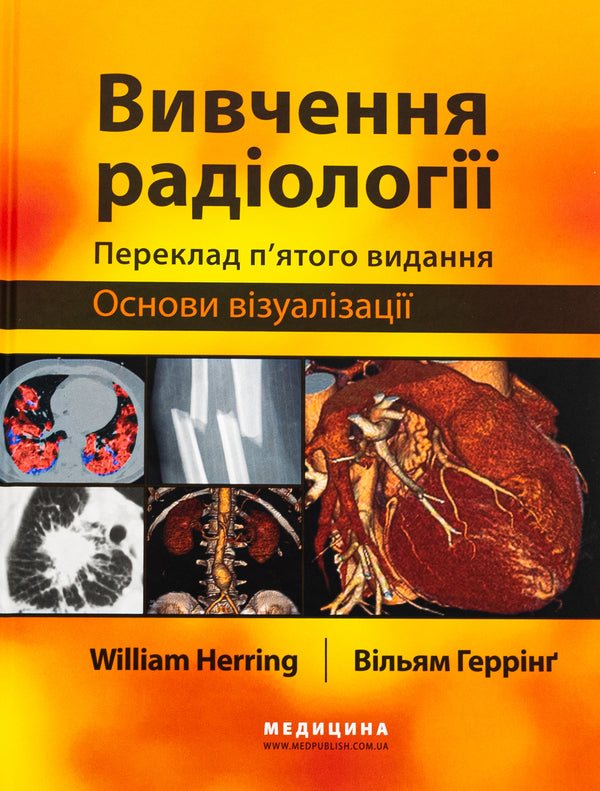 Study of radiology. Basics of visualization / Вивчення радіології. Основи візуалізації Уильям Херринг 978-617-505-971-5-1