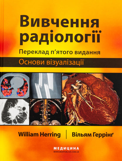 Study of radiology. Basics of visualization / Вивчення радіології. Основи візуалізації Уильям Херринг 978-617-505-971-5-1