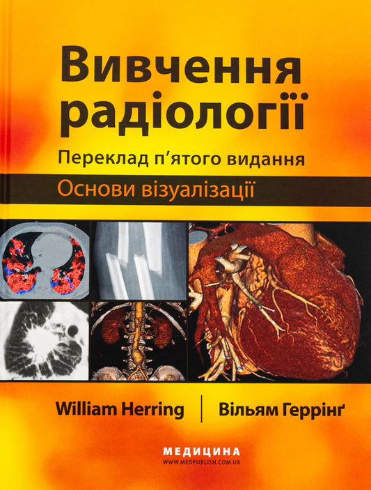 Study of radiology. Basics of visualization / Вивчення радіології. Основи візуалізації Уильям Херринг 978-617-505-971-5-1