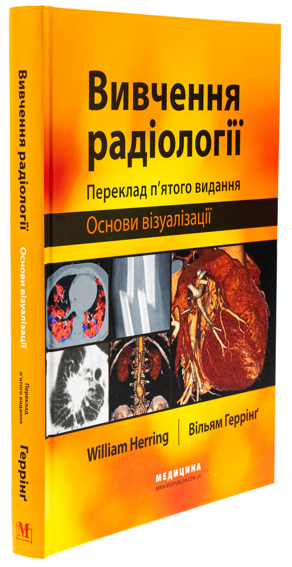 Study of radiology. Basics of visualization / Вивчення радіології. Основи візуалізації Уильям Херринг 978-617-505-971-5-3