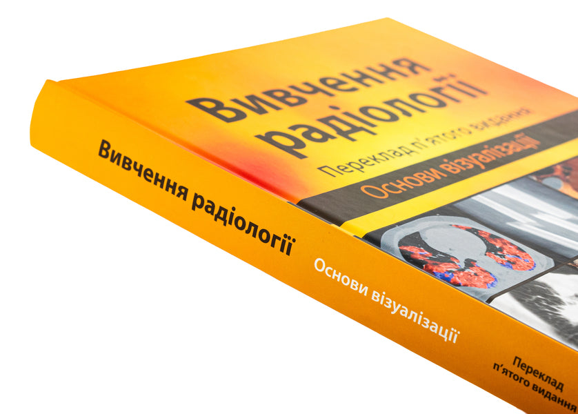 Study of radiology. Basics of visualization / Вивчення радіології. Основи візуалізації Уильям Херринг 978-617-505-971-5-4