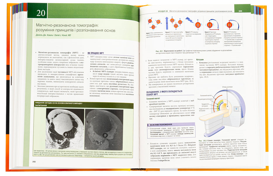 Study of radiology. Basics of visualization / Вивчення радіології. Основи візуалізації Уильям Херринг 978-617-505-971-5-5